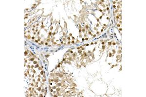 Immunohistochemistry (IHC) image for anti-Actin, alpha 2, Smooth Muscle, Aorta (ACTA2) (AA 1-124) antibody (ABIN6136473)