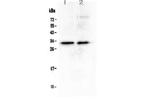 Western blot analysis of MED6 using anti-MED6 antibody .
