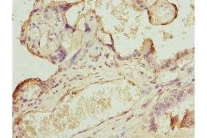 Immunohistochemistry of paraffin-embedded human placenta tissue using ABIN7146436 at dilution of 1:100 (CAMK1D 抗体  (AA 1-180))
