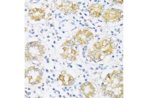 Immunohistochemistry of paraffin-embedded human stomach using BRSK1 antibody  at dilution of 1:100 (40x lens). (BRSK1 抗体  (AA 310-510))