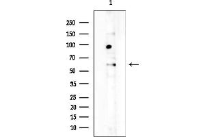 anti-Uromodulin (UMOD) (C-Term) antibody