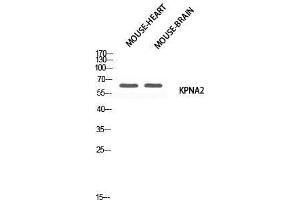 Western Blot (WB) analysis of Mouse Heart Mouse Brain using KPNA2 antibody. (KPNA2 抗体)