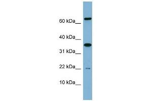 RWDD1 antibody used at 1 ug/ml to detect target protein. (RWDD1 抗体  (Middle Region))