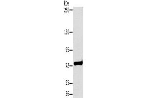 Western Blotting (WB) image for anti-Hydroxysteroid (17-Beta) Dehydrogenase 4 (HSD17B4) antibody (ABIN2430255) (HSD17B4 抗体)
