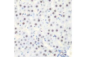 Immunohistochemistry of paraffin-embedded rat liver using CASP9 antibody at dilution of 1:100 (40x lens). (Caspase 9 抗体)