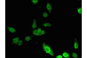 Immunofluorescent analysis of Hela cells using ABIN7156257 at dilution of 1:100 and Alexa Fluor 488-congugated AffiniPure Goat Anti-Rabbit IgG(H+L) (ING5 抗体  (AA 32-207))