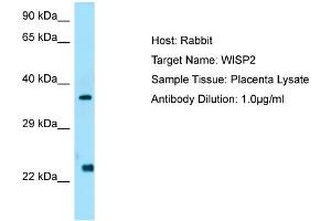 Host: Rabbit  Target Name: WISP2  Antibody Dilution: 1. (WISP2 抗体  (C-Term))