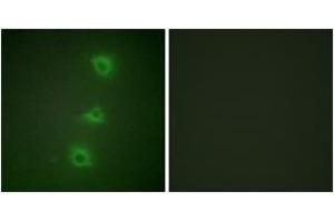 Immunofluorescence analysis of HuvEc cells, using B-RAF Antibody. (SNRPE 抗体  (AA 171-220))