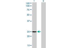 Western Blot analysis of THAP1 expression in transfected 293T cell line by THAP1 monoclonal antibody (M01), clone 2C1-2F2. (THAP1 抗体  (AA 1-213))