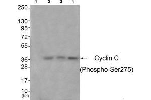 Western blot analysis of extracts from 3T3 cells (Lane 2), A549 cells (Lane 3) and Hela cells (Lane 4), using Cyclin C (Phospho-Ser275) Antibody. (Cyclin C 抗体  (pSer275))