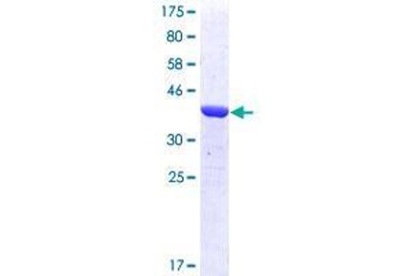 TPX2 Protein (AA 648-747) (GST tag)