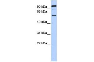 WB Suggested Anti-GABRR1 Antibody Titration:  0. (GABRR1 抗体  (N-Term))