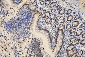 IHC analysis of BRG1 using anti-BRG1 antibody (ABIN7602029).
