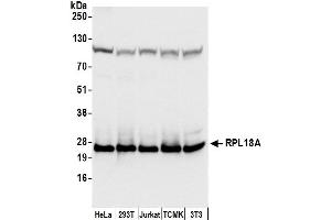 anti-Ribosomal Protein L18a (RPL18A) (AA 126-176) antibody