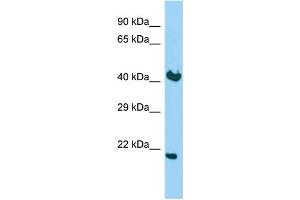 Host: Rabbit Target Name: KDELR2 Sample Type: Fetal Brain lysates Antibody Dilution: 1. (KDELR2 抗体  (C-Term))