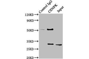 Immunoprecipitating CENPK in Hela whole cell lysate Lane 1: Rabbit control IgG instead of ABIN7147366 in Hela whole cell lysate. (CENPK 抗体  (AA 1-269))