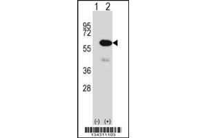 Western blot analysis of METAP2 using rabbit polyclonal METAP2 Antibody using 293 cell lysates (2 ug/lane) either nontransfected (Lane 1) or transiently transfected (Lane 2) with the METAP2 gene. (METAP2 抗体  (N-Term))