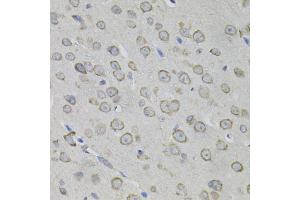 Immunohistochemistry of paraffin-embedded mouse brain using MYO10 antibody. (Myosin X 抗体)