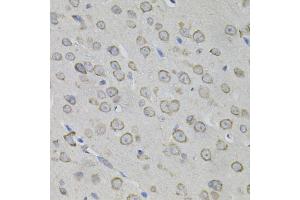 Immunohistochemistry of paraffin-embedded mouse brain using MYO10 antibody.