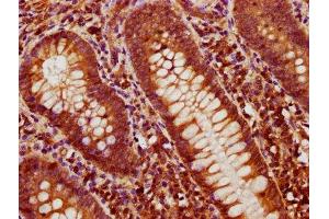 IHC image of ABIN7145692 diluted at 1:600 and staining in paraffin-embedded human appendix tissue performed on a Leica BondTM system. (BMP4 抗体  (AA 303-408))