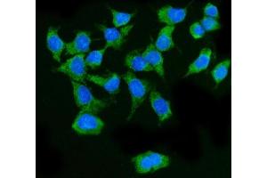 IF analysis of MAVS using anti-MAVS antibody (ABIN7603227).