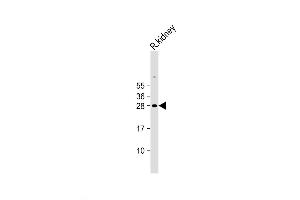 Western Blot at 1:2000 dilution + Rat kidney lysate Lysates/proteins at 20 ug per lane. (EPO 抗体  (N-Term))
