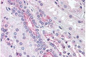 Immunohistochemistry (IHC) image for anti-Potassium Voltage-Gated Channel, Isk-Related Family, Member 3 (Kcne3) (Internal Region) antibody (ABIN1048983)