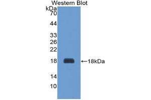 Detection of Recombinant AGRP, Rat using Polyclonal Antibody to Agouti Related Protein (AGRP) (AGRP 抗体  (AA 34-127))