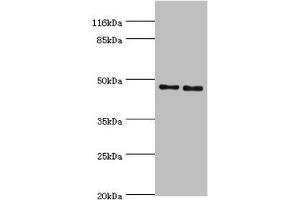 Western blot All lanes: Serpin H1 antibody at 2 μg/mL Lane 1: NIH/3T3 whole cell lysate Lane 2: A2780 whole cell lysate Secondary Goat polyclonal to rabbit IgG at 1/10000 dilution Predicted band size: 46 kDa Observed band size: 46 kDa (SERPINH1 抗体  (AA 139-418))