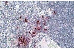 Immunohistochemistry (IHC) image for anti-DEFA1/3 (Internal Region) antibody (ABIN2464584) (DEFA1/3 (Internal Region) 抗体)