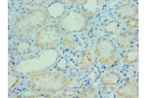 Immunohistochemistry of paraffin-embedded human kidney tissue using ABIN7163755 at dilution of 1:100 (PARP3 抗体  (AA 294-533))