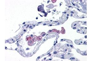 Human Lung: Formalin-Fixed, Paraffin-Embedded (FFPE) (TLR7 抗体  (AA 900-950))