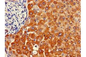 Immunohistochemistry of paraffin-embedded human liver tissue using ABIN7144675 at dilution of 1:100 (NAT1 抗体  (AA 1-288))