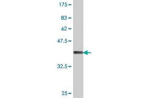 Western Blot detection against Immunogen (37 KDa) . (DDX1 抗体  (AA 642-740))