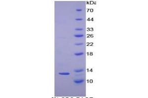 SDS-PAGE of Protein Standard from the Kit (Highly purified E.