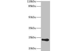 Western blot All lanes: RCVRN antibody at 2 μg/mL + Mouse eye tissue Secondary Goat polyclonal to rabbit IgG at 1/10000 dilution Predicted band size: 24 kDa Observed band size: 24 kDa (Recoverin 抗体  (AA 2-200))