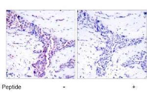 Image no. 1 for anti-Activating Transcription Factor 2 (ATF2) (Thr55), (Thr73) antibody (ABIN197150) (ATF2 抗体  (Thr55, Thr73))
