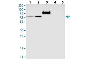 Western blot analysis of Lane 1: RT-4, Lane 2: U-251 MG, Lane 3: Human Plasma, Lane 4: Liver, Lane 5: Tonsil with GARNL4 polyclonal antibody  at 1:250-1:500 dilution. (RAP1GAP2 抗体)