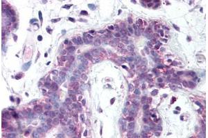 Human Breast (formalin-fixed, paraffin-embedded) stained with PRMT6 antibody ABIN218313 at 1:100 followed by biotinylated goat anti-rabbit IgG secondary antibody ABIN481713, alkaline phosphatase-streptavidin and chromogen. (PRMT6 抗体  (AA 23-43))