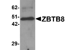Western Blotting (WB) image for anti-Zinc Finger and BTB Domain Containing 8A (ZBTB8A) (C-Term) antibody (ABIN1030814) (ZBTB8A 抗体  (C-Term))