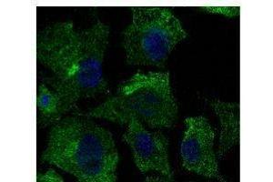 Anti-Calnexin Ab at 1/500 dilution, lysates at 50 per Iane, rabbit polyclonal to goat lµg (HRP) at 1/10,000 dilution, (Caveolin-1 抗体  (N-Term))