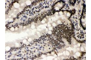 IHC testing of FFPE rat intestine with CSNK1A1 antibody. (CSNK1A1 抗体)