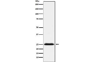 Western Blotting (WB) image for anti-B-Cell Receptor-Associated Protein 31 (BCAP31) antibody (ABIN7607010)