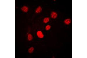 Immunofluorescent analysis of C/EBP beta (pT235) staining in HEK293T cells. (CEBPB 抗体  (pSer235))