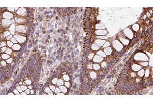 ABIN6272937 at 1/100 staining Mouse colon tissue by IHC-P. (BBS2 抗体  (C-Term))