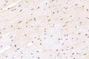 Immunohistochemistry analysis of paraffin-embedded mouse heart using,ZNF154 (ABIN7076261) at dilution of 1: 4000 (ZNF154 抗体)