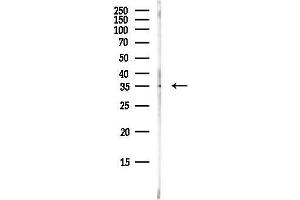 Western blot analysis of lysates from HepG2 cells(heat-shock, 45 min treatment), using EBP50 Antibody at 1/1000 dilution.