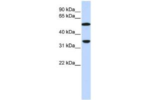 WB Suggested Anti-C4B Antibody Titration:  0.