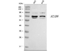 Western blot analysis of ACAD9 using anti-ACAD9 antibody (ABIN7602670).