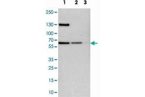 Western blot analysis of cell lysates with UPF3B polyclonal antibody  at 1:250-1:500 dilution. (UPF3B 抗体)